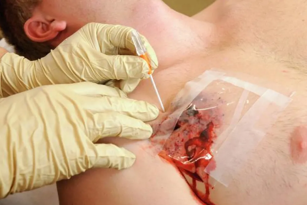 TyTek Medical Ensiapu ^ TPAK neula